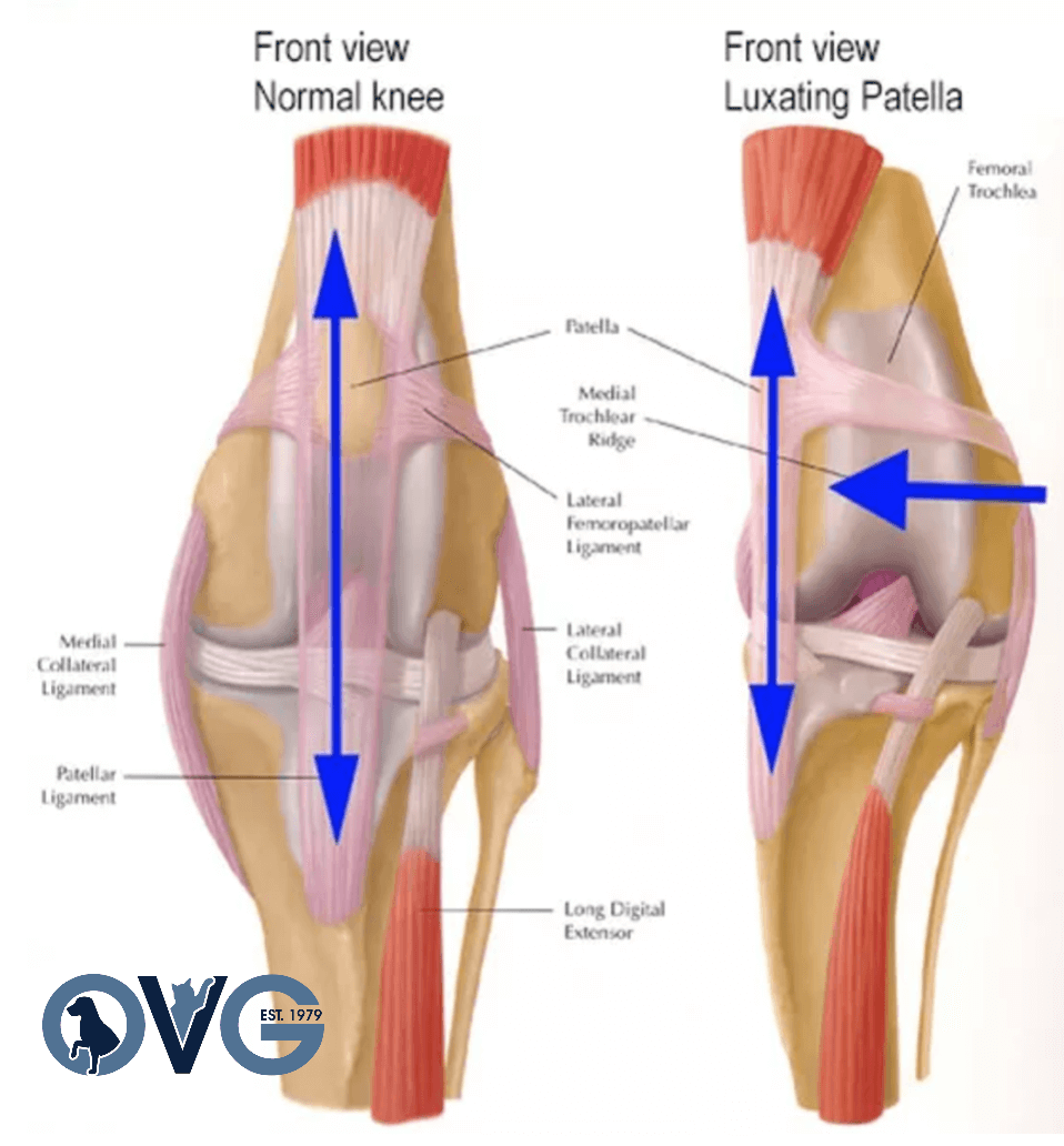 Loose patella deals